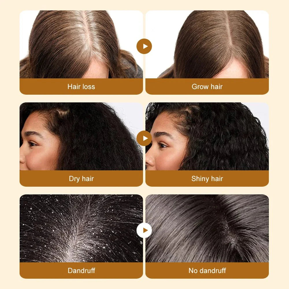Batana Hair Oil – Natural Hair Growth Oil for Thicker, Stronger & Healthier Hair