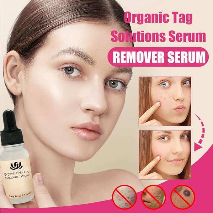 Organic Skin Tag Solutions Serum – Rose Cleansing Essential Oil (20ml)