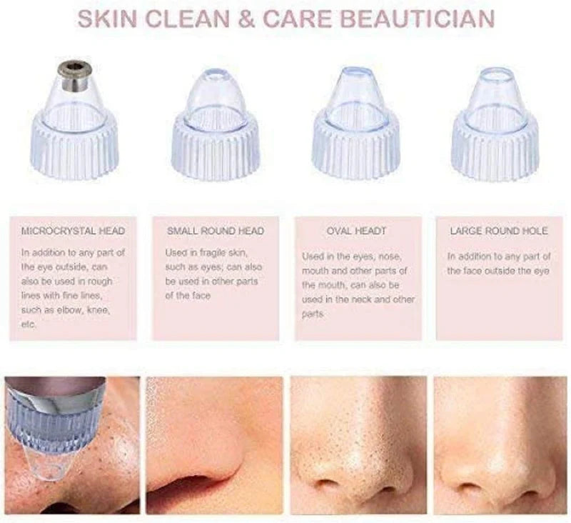 Blackhead Remover Pore Vacuum – USB Rechargeable Facial Pore Cleaner with 5 Suction Levels