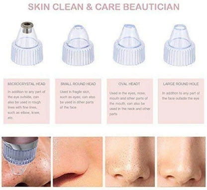Blackhead Remover Pore Vacuum – USB Rechargeable Facial Pore Cleaner with 5 Suction Levels