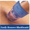 Blackhead Remover Pore Vacuum – USB Rechargeable Facial Pore Cleaner with 5 Suction Levels