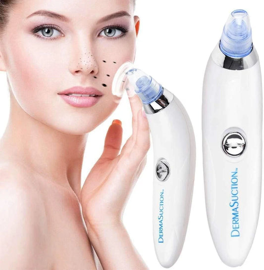 Blackhead Remover Pore Vacuum – USB Rechargeable Facial Pore Cleaner with 5 Suction Levels