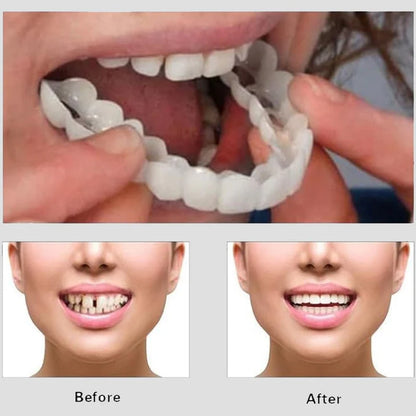 Snap On Smile - Teeth Cover
