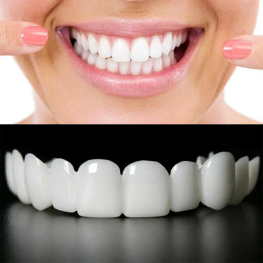 Snap On Smile - Teeth Cover