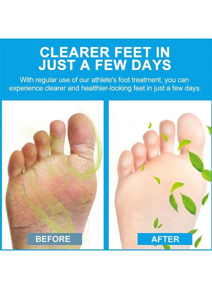 Sumifun Foot Antibacterial Cream with Tea Tree Oil – Foot Care Skin Repair Cream (20g)